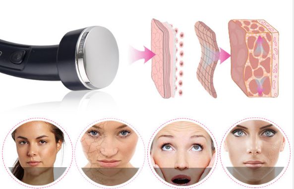 may lay chi va di duong chat tren da kd 612